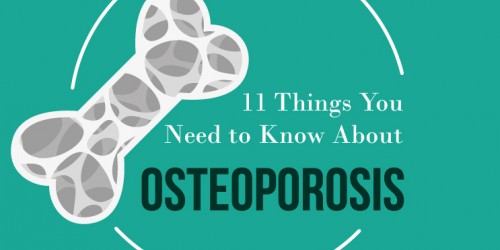 Understanding Osteoporosis: 11 Things You Should Know About Brittle Bones